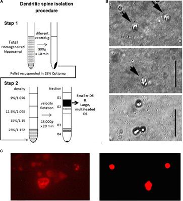 Electrical recordings from dendritic spines of adult mouse hippocampus and effect of the actin cytoskeleton